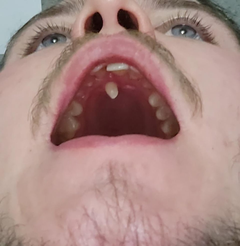 22 examples when a gene malfunction gave people a unique appearance chip 22 examples when a gene malfunction gave people a unique appearance chip