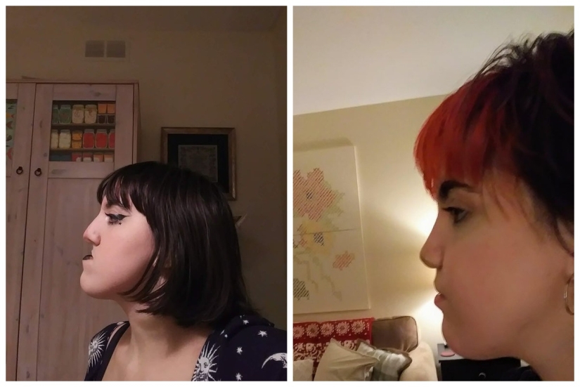 22 fotos interesantes de la serie "antes/después"