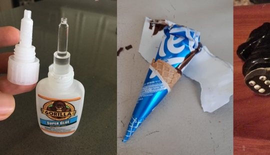 22 objetos extraños encontrados donde simplemente no podían ser 22 objetos extraños encontrados donde simplemente no podían ser