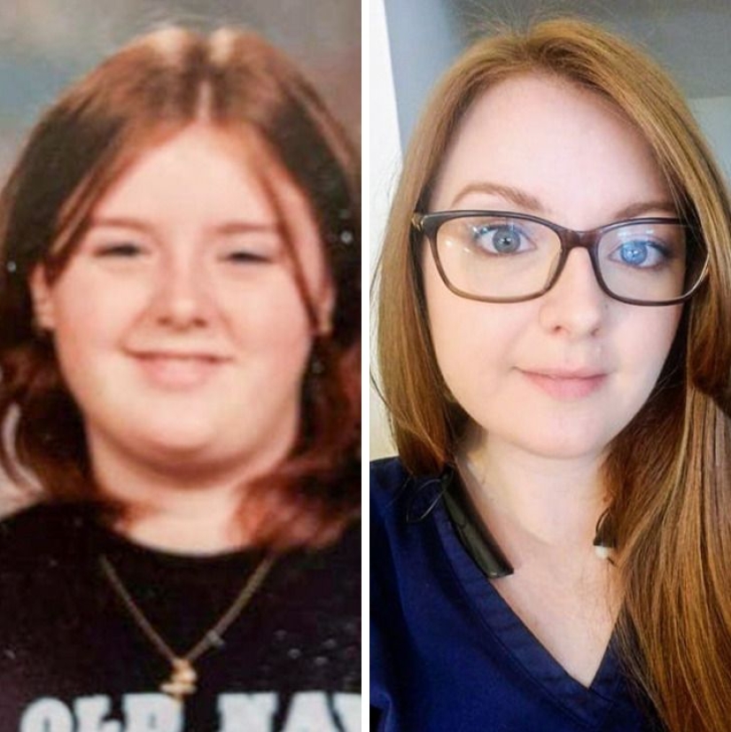 22 people who proved the truthfulness of the tale of the ugly duckling 22 people who proved the truthfulness of the tale of the ugly duckling