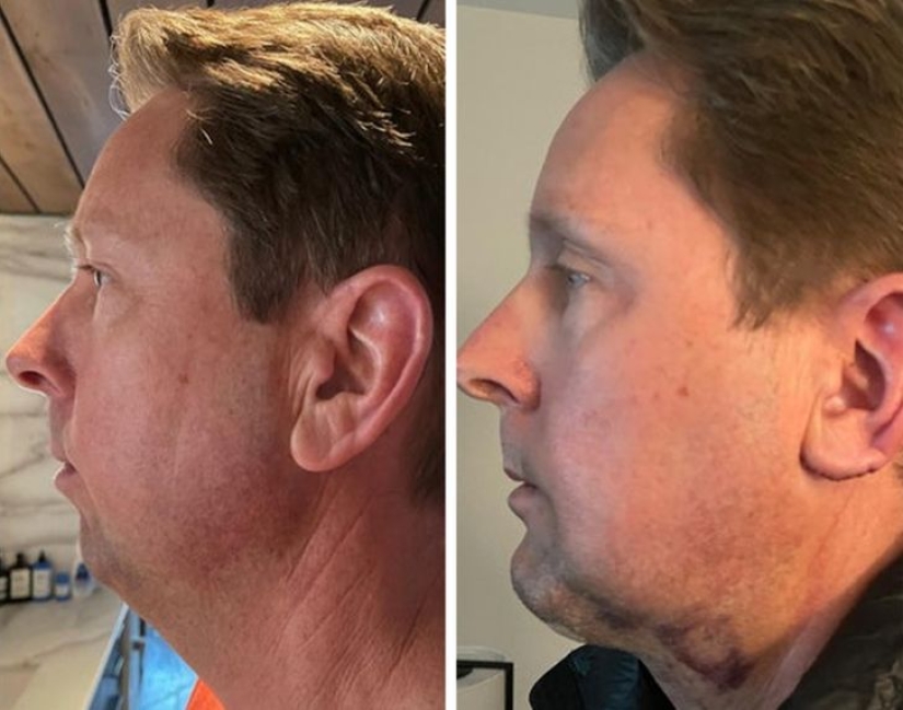 22 photos of people who went under the surgeon's knife and never regretted it 22 photos of people who went under the surgeon's knife and never regretted it
