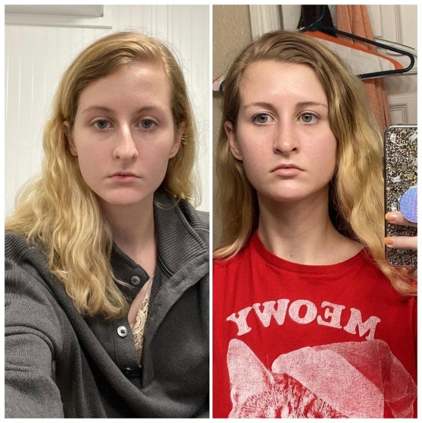 22 photos of people who went under the surgeon's knife and never regretted it 22 photos of people who went under the surgeon's knife and never regretted it