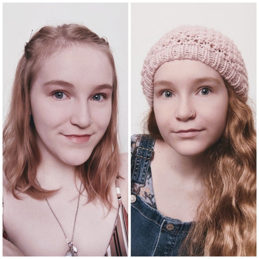 22 photos of people who went under the surgeon's knife and never regretted it 22 photos of people who went under the surgeon's knife and never regretted it