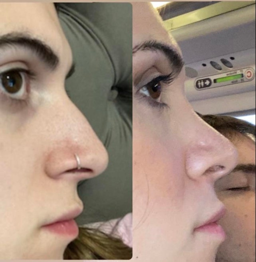 22 photos of people who went under the surgeon's knife and never regretted it 22 photos of people who went under the surgeon's knife and never regretted it