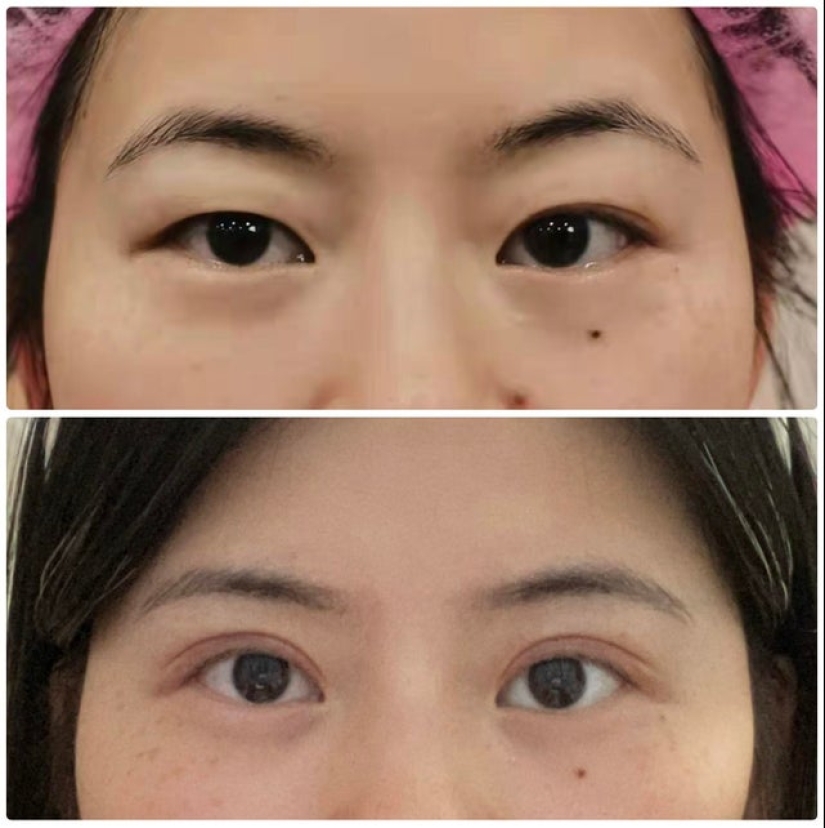 22 photos of people who went under the surgeon's knife and never regretted it 22 photos of people who went under the surgeon's knife and never regretted it