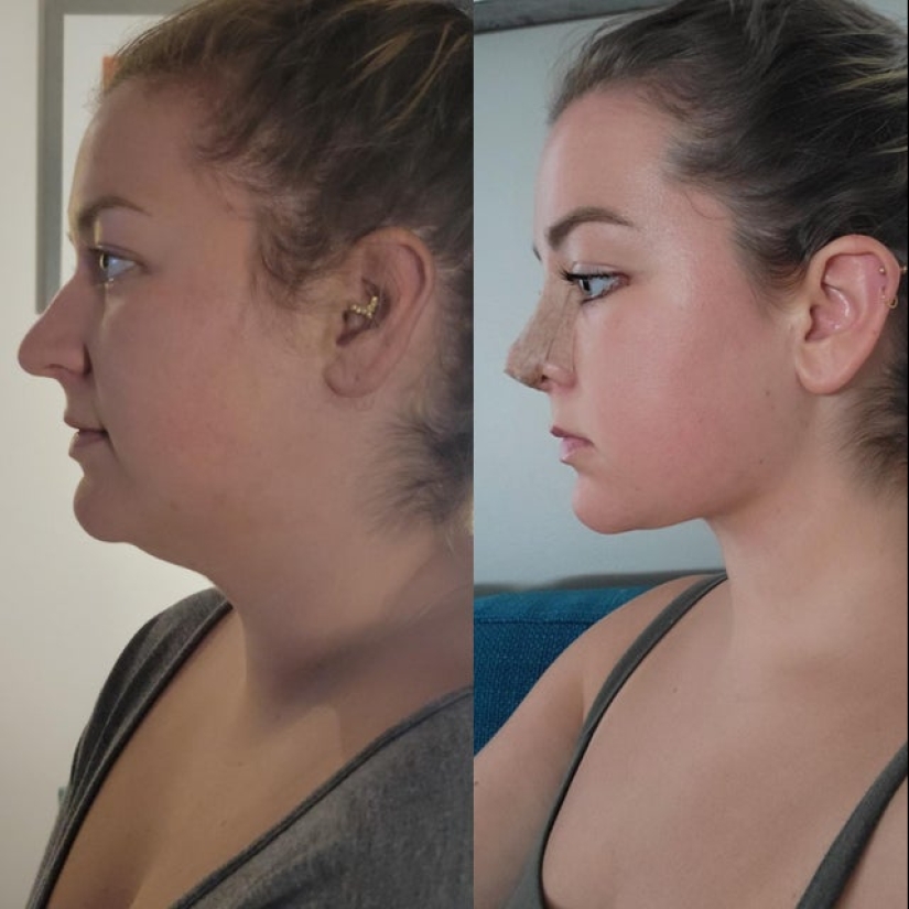 22 photos of people who went under the surgeon's knife and never regretted it 22 photos of people who went under the surgeon's knife and never regretted it