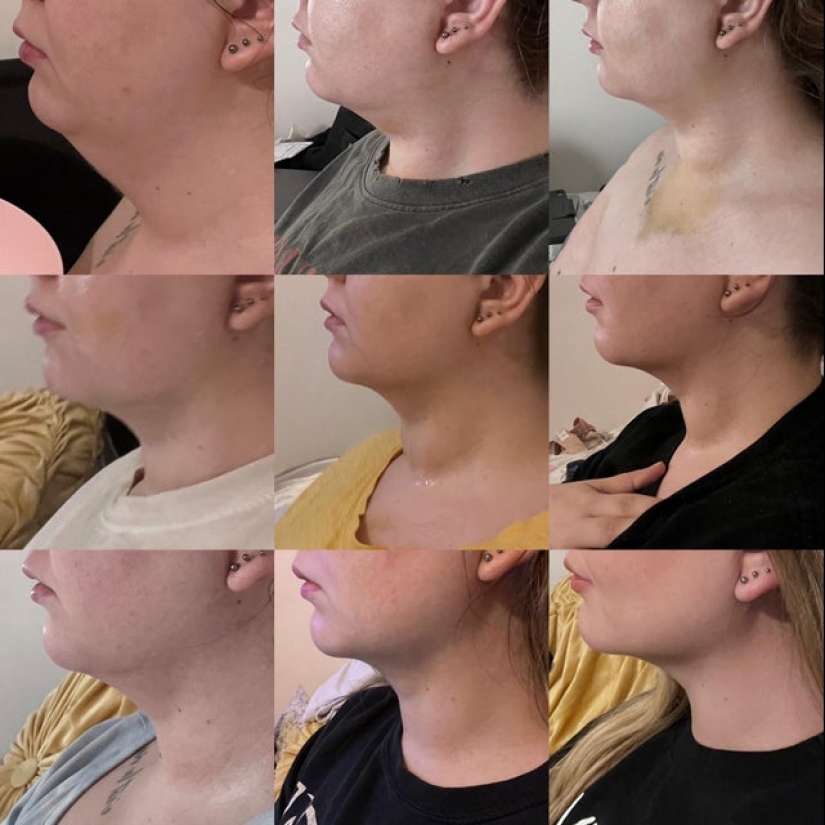 22 photos of people who went under the surgeon's knife and never regretted it 22 photos of people who went under the surgeon's knife and never regretted it