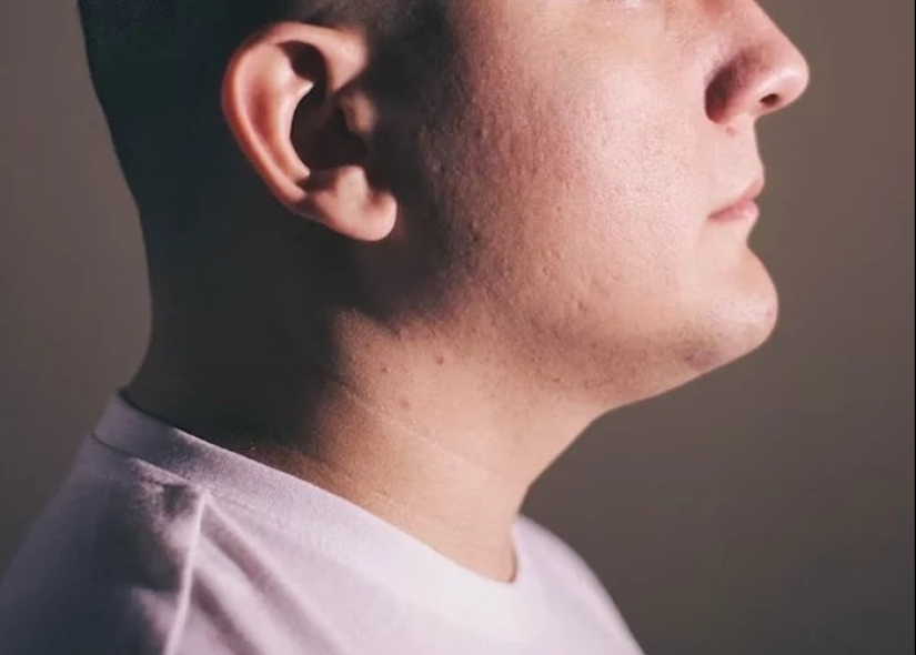 25 hechos extraños, espeluznantes y espeluznantes sobre el cuerpo humano 25 hechos extraños, espeluznantes y espeluznantes sobre el cuerpo humano