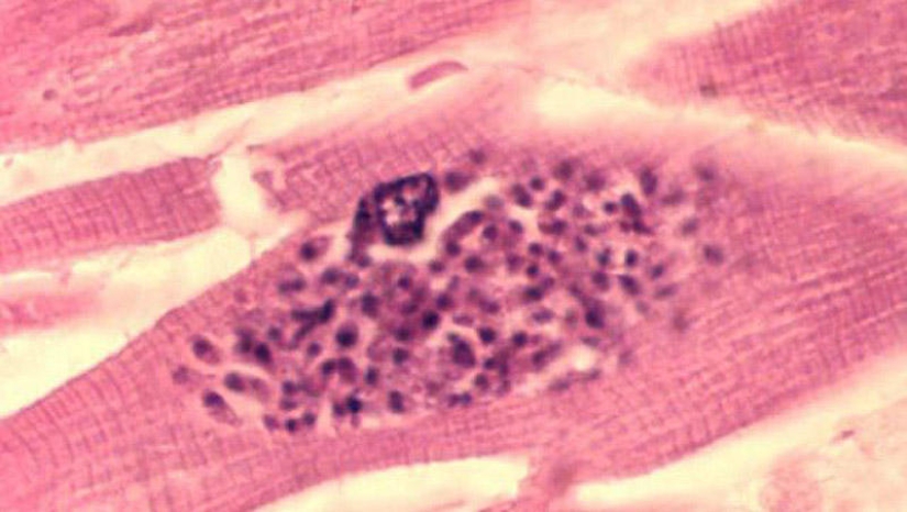 25 Most Unusual and Dangerous Parasites