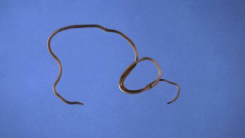 25 Most Unusual and Dangerous Parasites