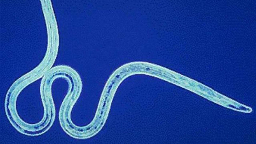 25 Most Unusual and Dangerous Parasites