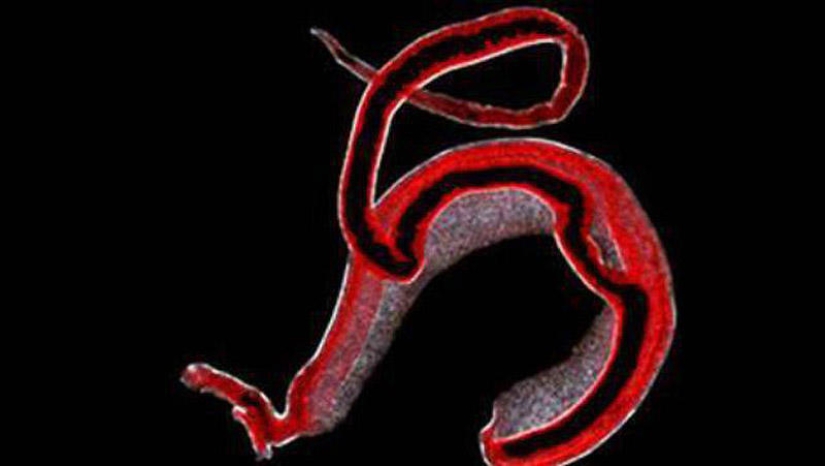 25 Most Unusual and Dangerous Parasites