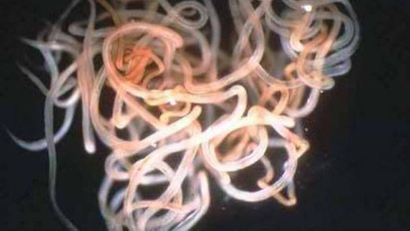 25 Most Unusual and Dangerous Parasites