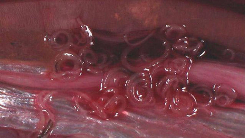 25 Most Unusual and Dangerous Parasites