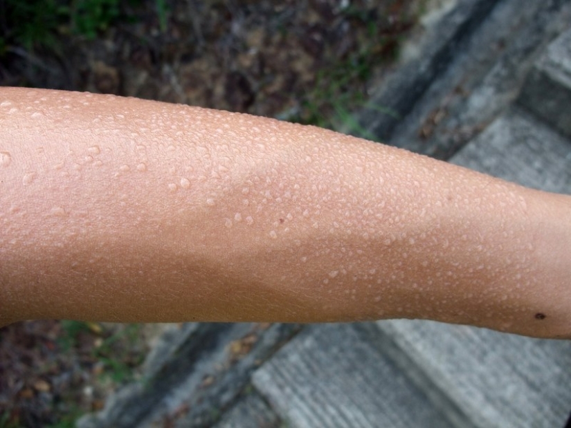 25 of the strangest diseases in the world that scientists still cannot explain 25 of the strangest diseases in the world that scientists still cannot explain