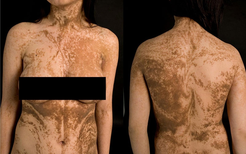 25 of the strangest diseases in the world that scientists still cannot explain 25 of the strangest diseases in the world that scientists still cannot explain