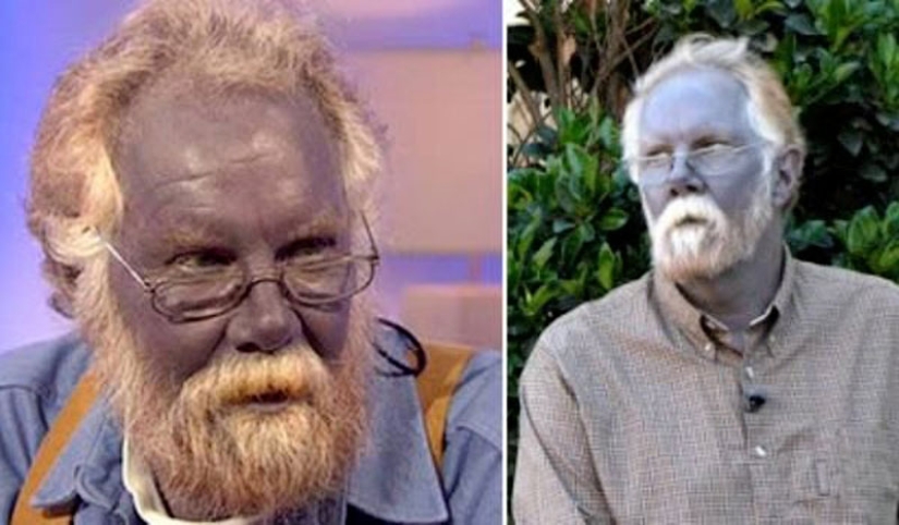 25 of the strangest diseases in the world that scientists still cannot explain 25 of the strangest diseases in the world that scientists still cannot explain