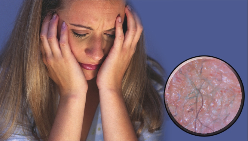 25 of the strangest diseases in the world that scientists still cannot explain 25 of the strangest diseases in the world that scientists still cannot explain