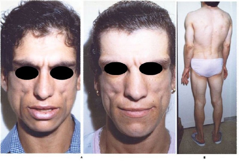 25 of the strangest diseases in the world that scientists still cannot explain 25 of the strangest diseases in the world that scientists still cannot explain