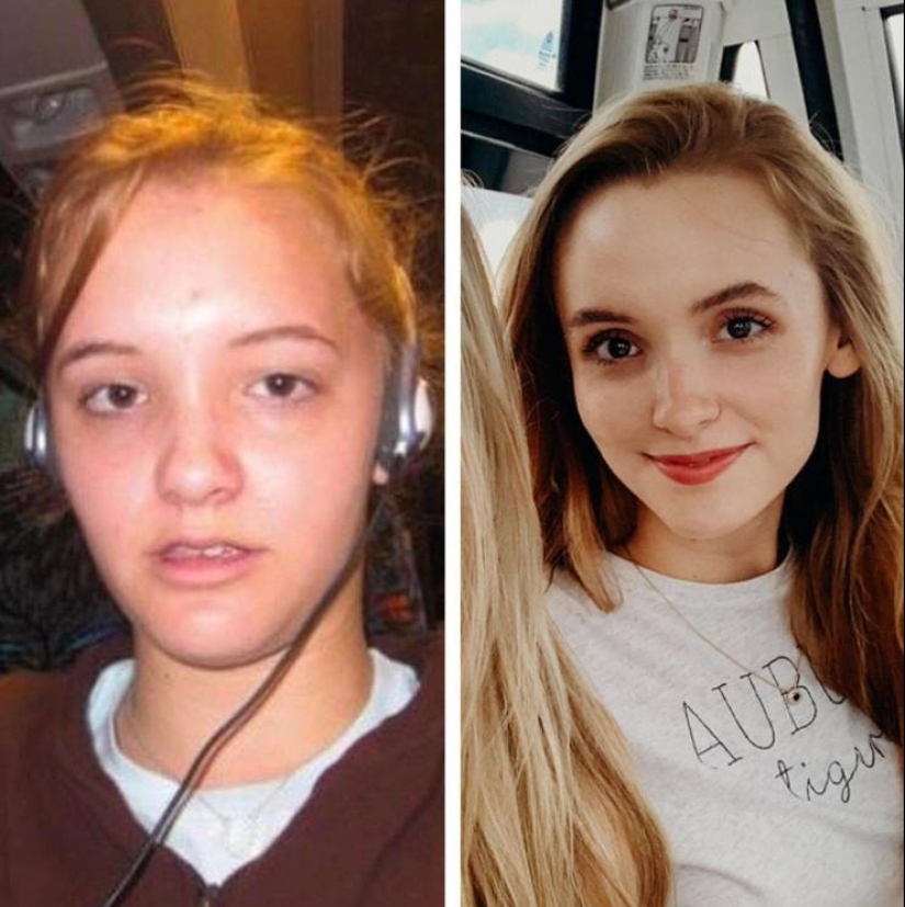 25 successful transformations from an ugly duckling to a beautiful Swan 25 successful transformations from an ugly duckling to a beautiful Swan