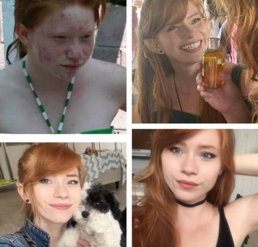 25 successful transformations from an ugly duckling to a beautiful Swan 25 successful transformations from an ugly duckling to a beautiful Swan