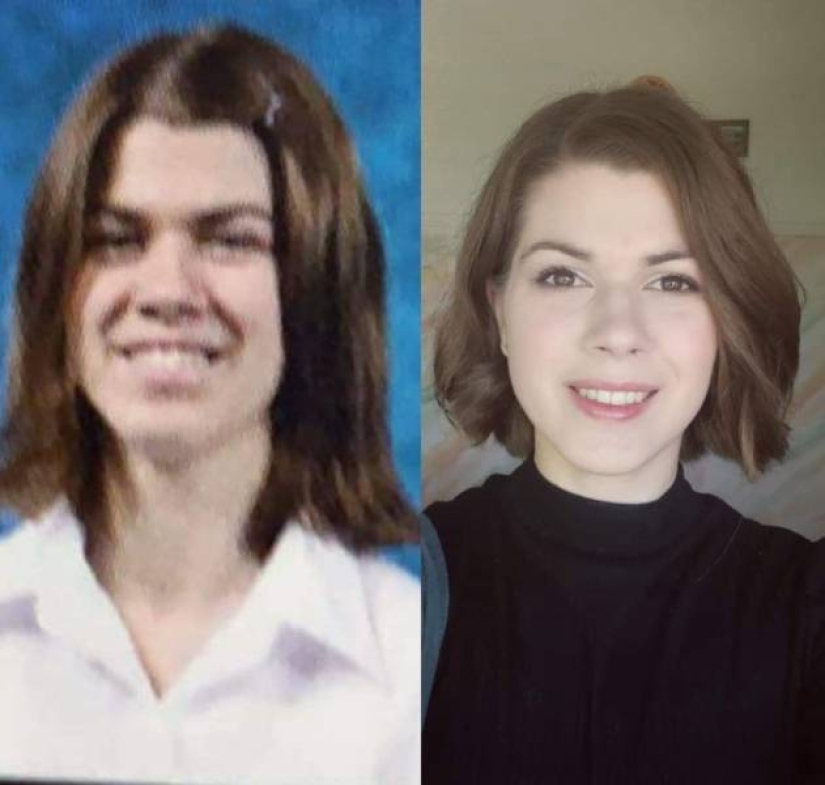 25 successful transformations from an ugly duckling to a beautiful Swan 25 successful transformations from an ugly duckling to a beautiful Swan