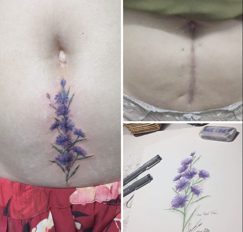25 tattoos to cover scars and other defects on the body