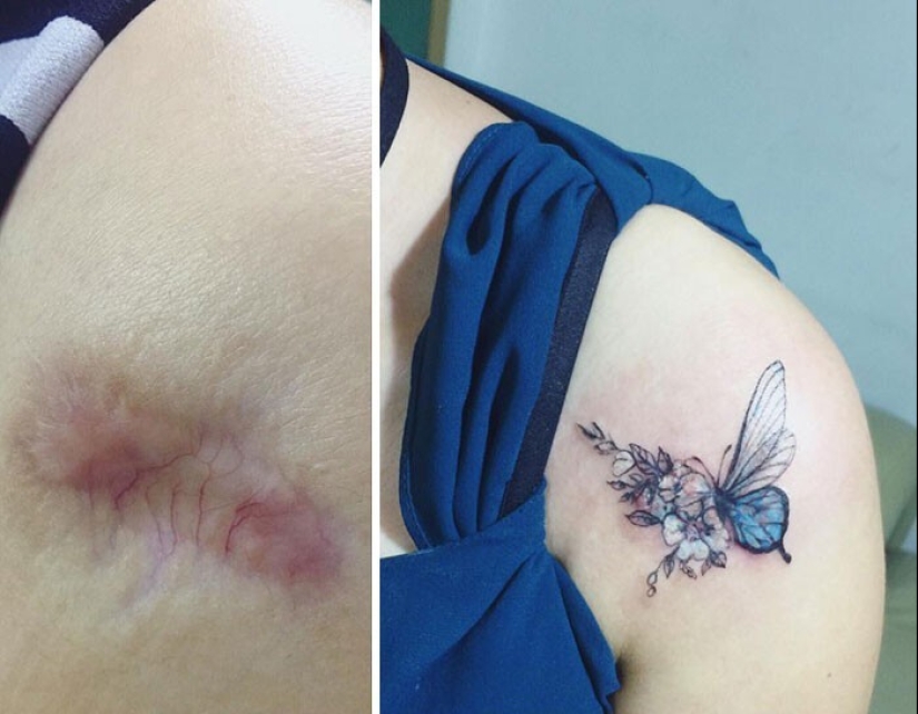 25 tattoos to cover scars and other defects on the body