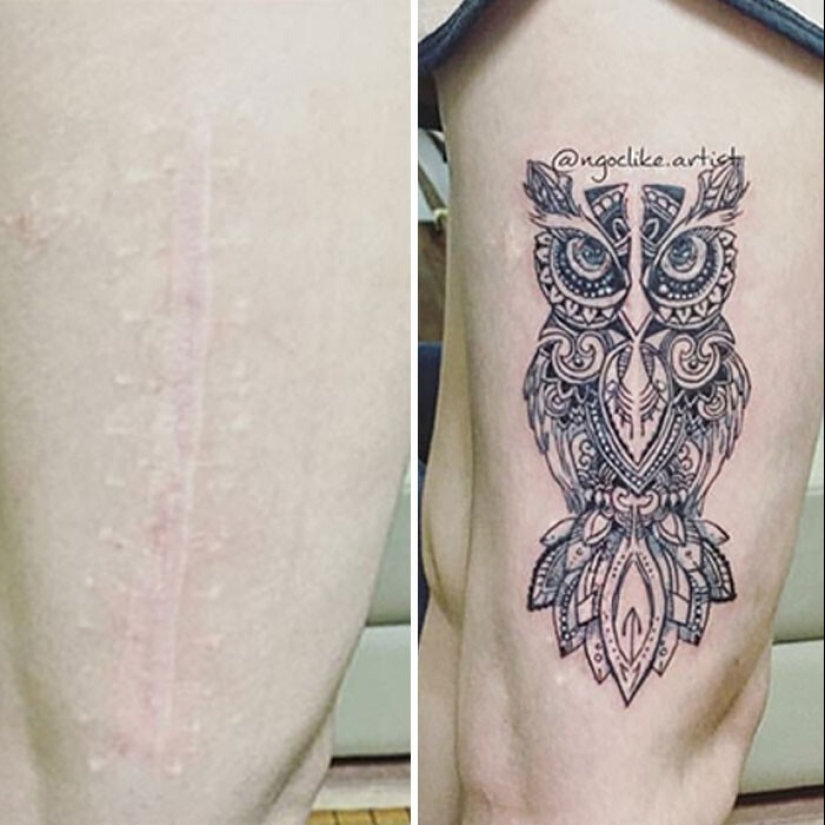 25 tattoos to cover scars and other defects on the body