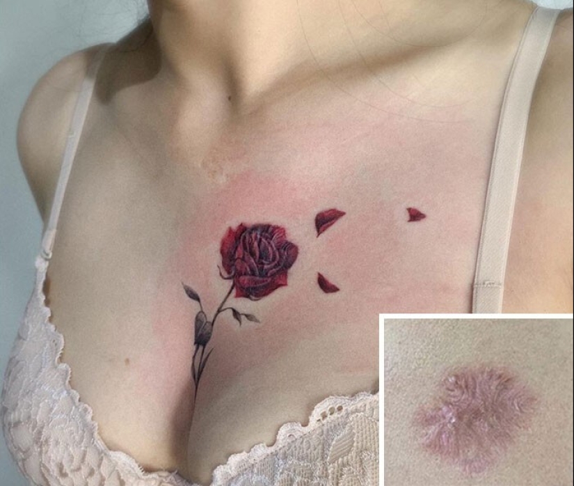 25 tattoos to cover scars and other defects on the body