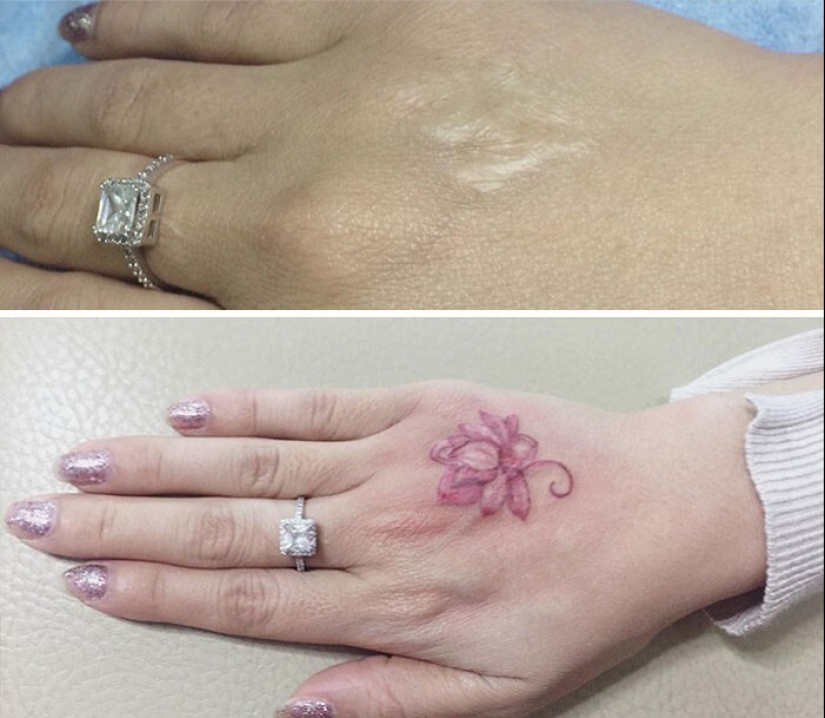 25 tattoos to cover scars and other defects on the body