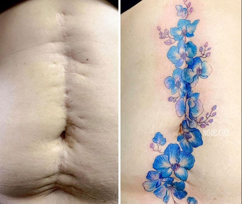 25 tattoos to cover scars and other defects on the body