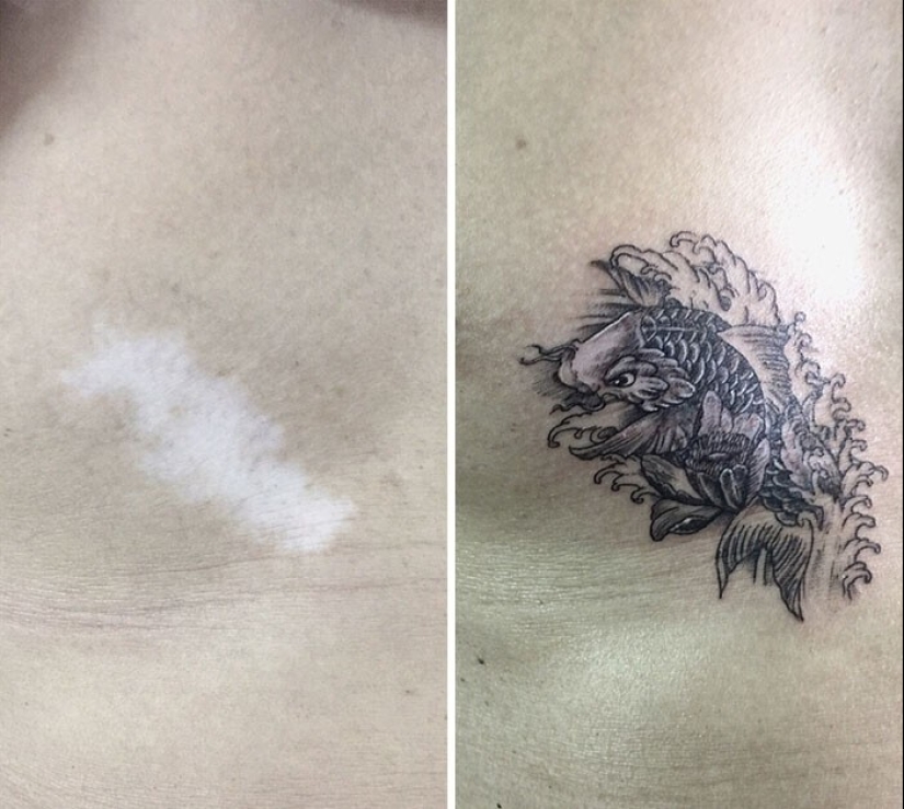 25 tattoos to cover scars and other defects on the body