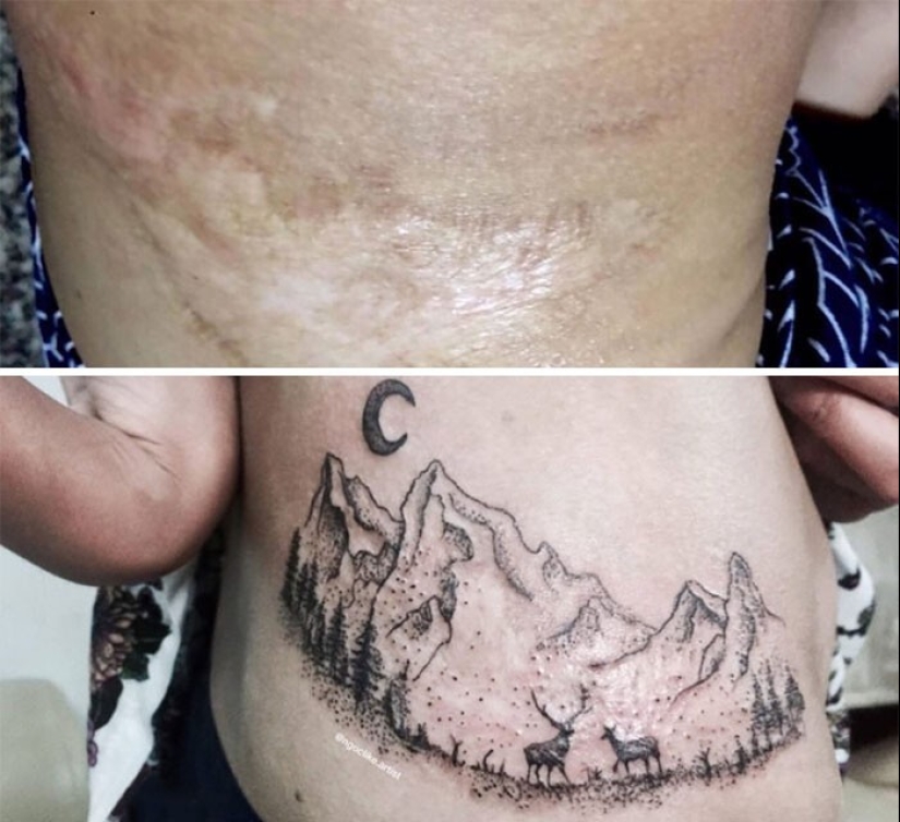 25 tattoos to cover scars and other defects on the body