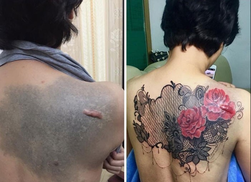 25 tattoos to cover scars and other defects on the body