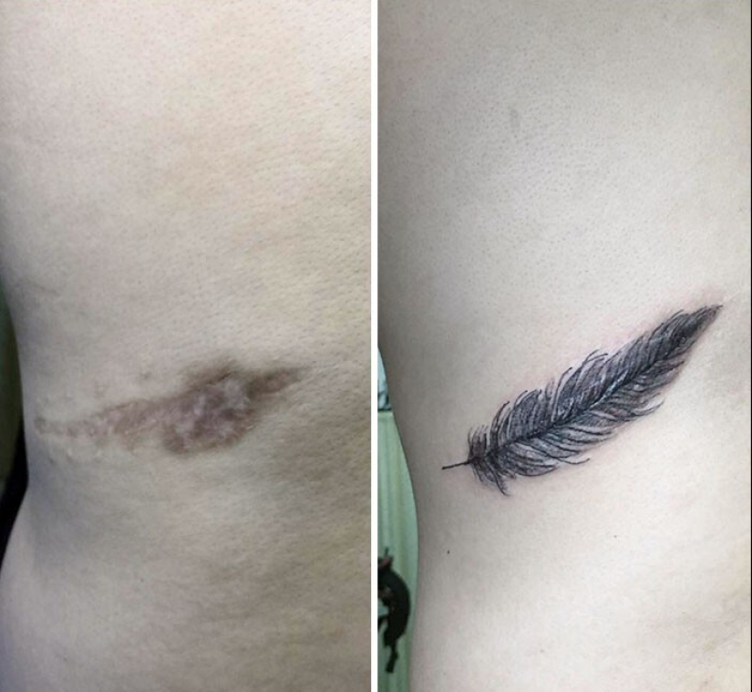 25 tattoos to cover scars and other defects on the body