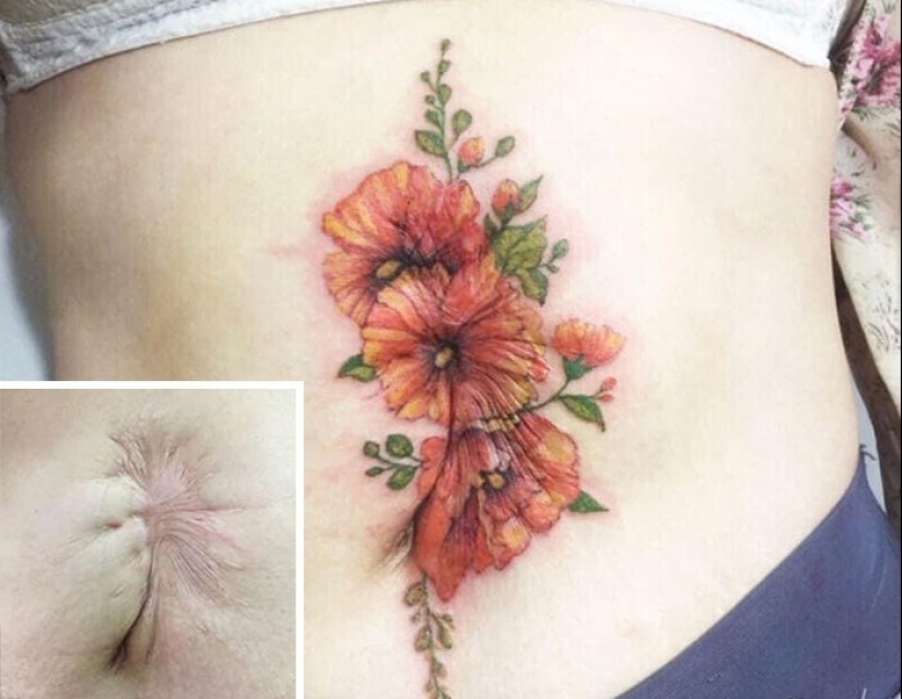25 tattoos to cover scars and other defects on the body