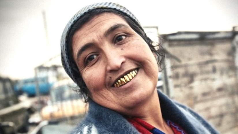 3 Reasons why Gypsies Give themselves Gold Teeth 3 Reasons why Gypsies Give themselves Gold Teeth