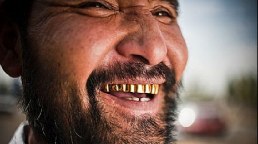 3 Reasons why Gypsies Give themselves Gold Teeth 3 Reasons why Gypsies Give themselves Gold Teeth