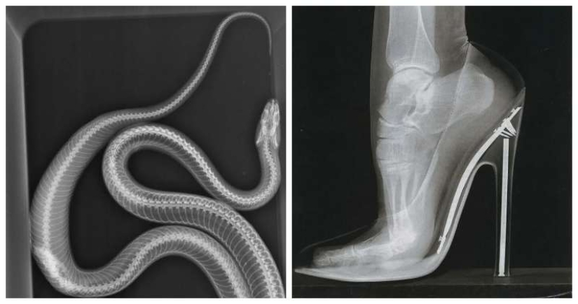 35 x-ray images that reveal the world from an unexpected quarter