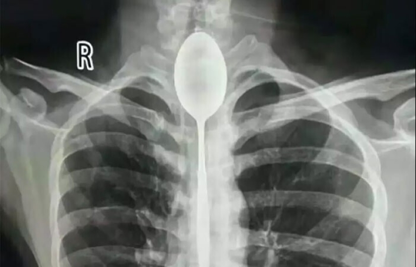 35 x-ray images that reveal the world from an unexpected quarter