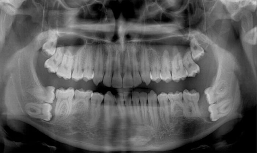 35 x-ray images that reveal the world from an unexpected quarter