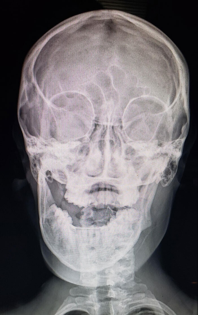 35 x-ray images that reveal the world from an unexpected quarter