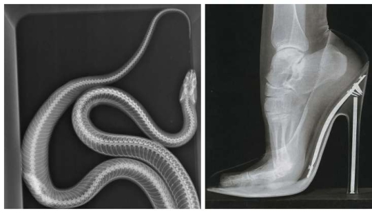 35 x-ray images that reveal the world from an unexpected quarter