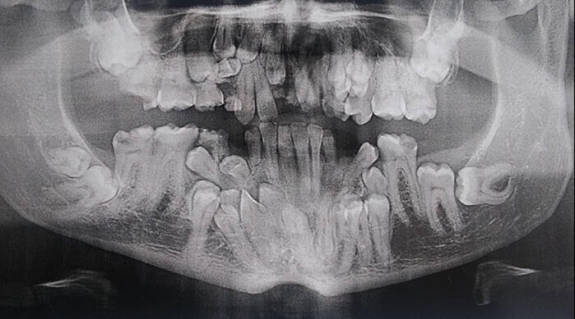 35 x-ray images that reveal the world from an unexpected quarter