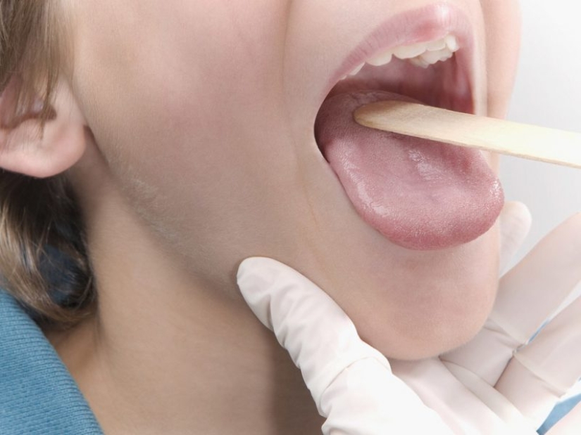 5 enfermedades inesperadas que se transmiten a través de un beso