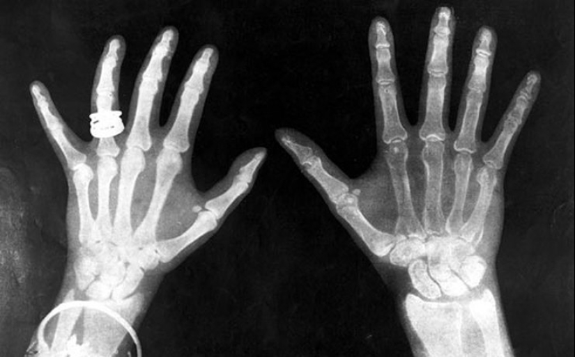 6 dangerous cosmetics of the past, from which women died painfully 6 dangerous cosmetics of the past, from which women died painfully