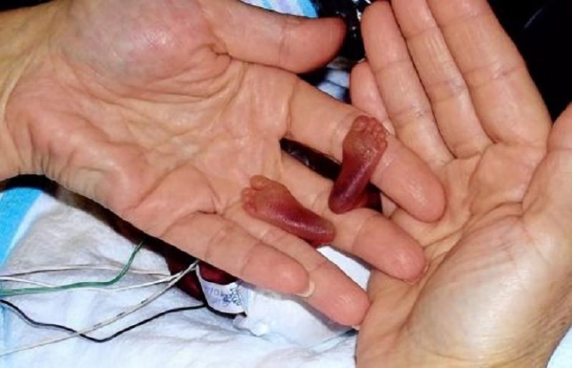 7 incredible stories of survival of babies 7 incredible stories of survival of babies