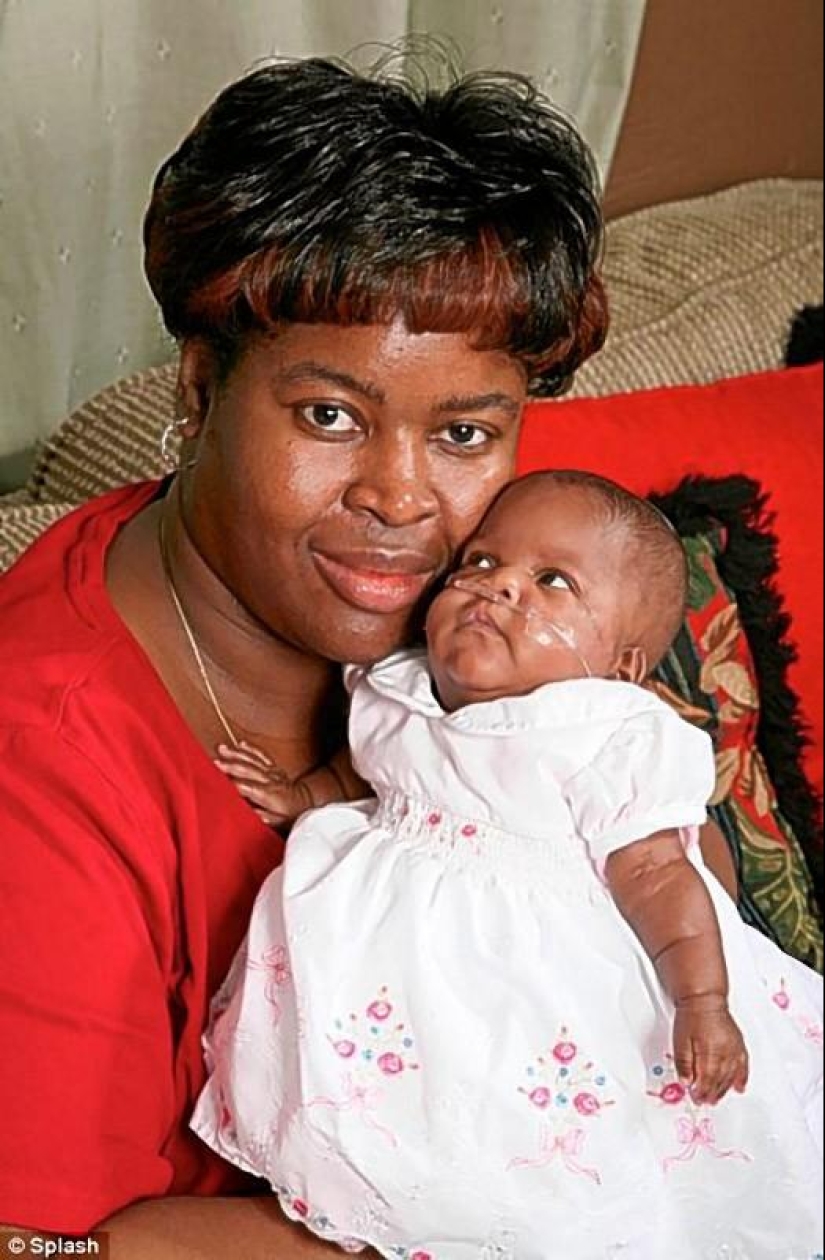 7 incredible stories of survival of babies 7 incredible stories of survival of babies