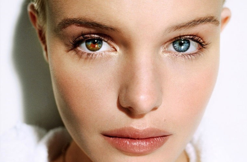 8 anomalías que demostrar lo impredecible de la genética